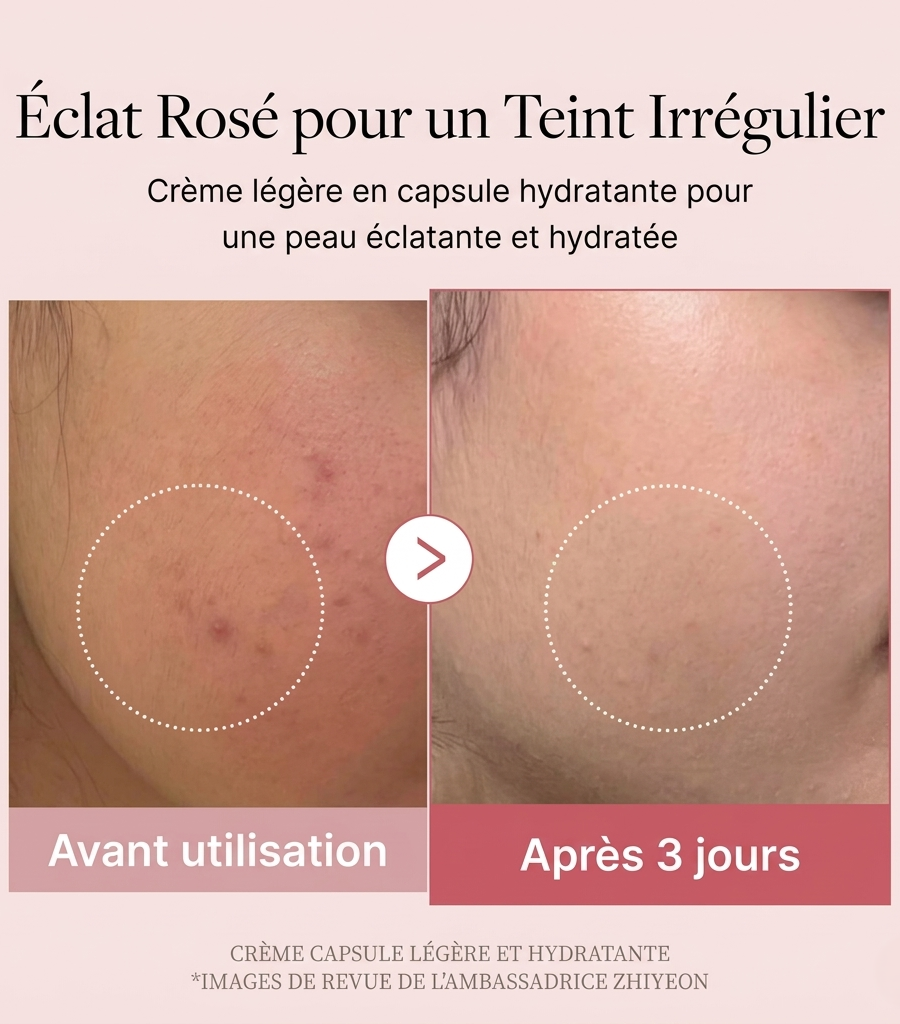 Résultats avant / après