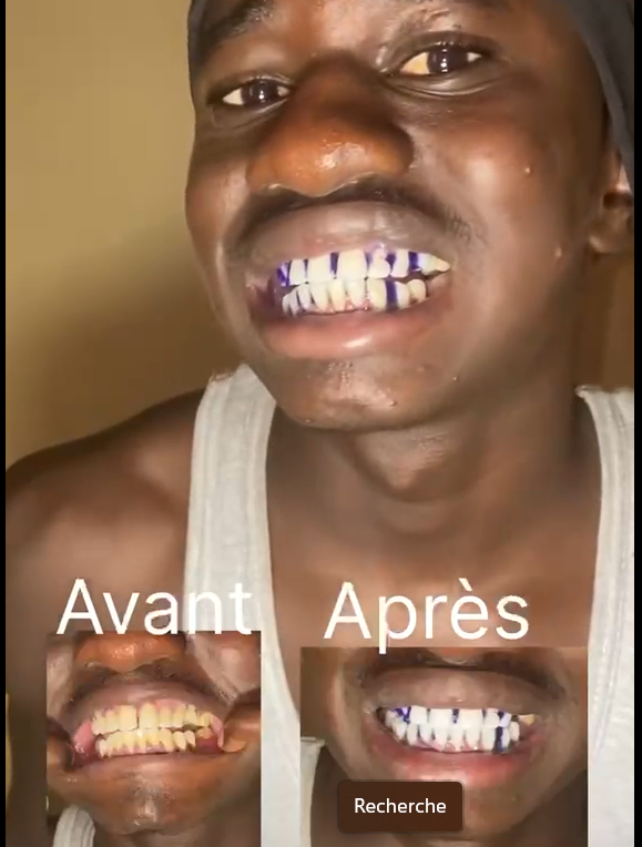 Avis de junior
